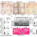 Interleukin-22 Induces Hepatic Stellate Cell Senescence and Restricts Liver 이미지
