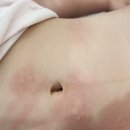 무등미래약국 | 공동체, 24개월 구몬 학습지 시작, 공부 시작하는 아기책상의자 추천, 느닷없이 알러지, 무등시장 야시장)