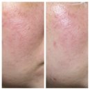 제네비 | 비보라 제네온 RG3 리바이브 앰플 피부 윤기 기록