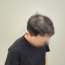 인유카페 | [내돈내산 울산두피문신 후기] 정수리탈모 흑채인생 탈출했어요 !! "헤드라인유울산점"