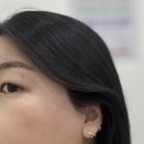 부산서울하정외과의원 | 서면 왁싱 잘하는 곳 우아한봄 첫인상라인 관리 후기｜부산헤어라인왁싱 부산눈썹왁싱 추천
