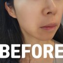 을-180 | 의왕에스테틱 180도스킨샵에서 림프관리와 페이스관리받고 리프팅 된 후기