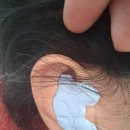 굿모닝보청기 | 파동보청기 굿모닝보청기 꼼꼼한 검사 상담 후기