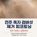 김제장문외과의원 | 전주 검버섯 제거 흑자 제거 피코토닝 비에스 성형외과