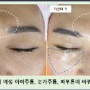 미라클 테라피