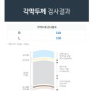 김희철동서한방병원 | |강남역 렌즈삽입술| ① 검안부터 EVO ICL 렌즈삽입술 수술 결정까지