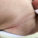 쥬니 | 아기 오돌토돌 피부 때문에 바꿔본 보습크림 쥬니리프 버드미 후기