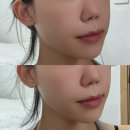 지성피부 파운데이션 쿠션팩트 추천 워니스초이스 올인원 듀얼 쿠션 후기