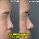 제이티성형외과의원 이미지