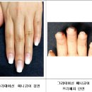 프레네일