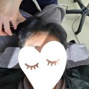 모리온 두피탈모 광교점