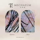 미채움뷰티샵 | 잠실석촌 두피케어 전문점에서 두피 건강 되찾은 날 [미채움 두피 스킨바디 잠실석촌점]