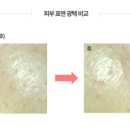 피부빛나다 네이버블로그