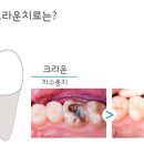 쎈 치과기공소 이미지