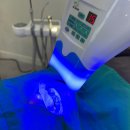 오늘도 편안하개 | 용인 기흥구 치아미백 후기, 1회 방문으로 2회 시술 가능 | 인상이 달라지는 환한 미소 😁