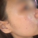 동일하이빌 후문 횡단보도 | 충북혁신도시피부관리 “ 물톡스 수분관리 ” 후기 라온뷰티 충북혁신점