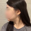 청담이라인치과의원 | 청담 온다리프팅 이중턱 리프팅 효과 턱라인 변화 솔직후기