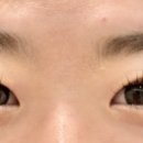 눈데이 이미지