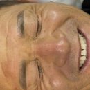 브로우난