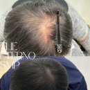 곳 | 대전 두피 문신 잘하는 곳, 후기 좋은 곳 추천