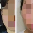 여주금강의원 | 경기도 여주시 피부과 전문 병원 BEST 추천 6곳