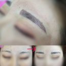 아이미의원 | 이대역 자연눈썹, 아이미에서 예쁘게 하고 왔다