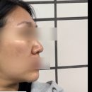 [리엔케이] 신한카드 제휴 마케팅 이벤트 무료체험 및 환불 후기