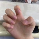 프롬피치
