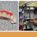 홍천치과기공소 이미지