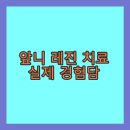 광님치과기공소 | 앞니 레진 치료 실제 경험담