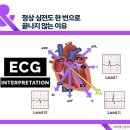 유대현나경선내과의원 | 원인 모를 뇌졸중이라면? 심장 모니터링이 길어지는 이유