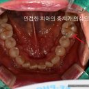 올바로치과의원 네이버블로그