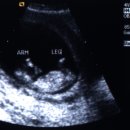 돼지우리 이미지