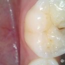 최종호치과의원 | 아이가 자발적으로 양치할 수 있게 하는 교육을 알려드려요