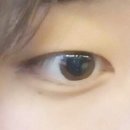 이슬기안과의원 | 라식 후기/라식 안과 추천/라식 병원/강남 안과/강남 안과 잘하는 곳/라식 가격/라식 병원 추천/라식...