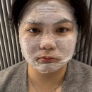 샤넬 | [대구 중구] 대구 동성로피부과 여드름 치료 포텐자+엑소샤넬 체험후기