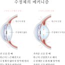 써밋안경원 이미지