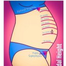 하이베베 이미지