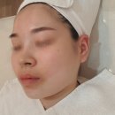 미더베스트 부천점 | 부천피부관리 문제성 스킨 케어 잘하는 미더베스트