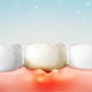 더이로운치과병원 이미지