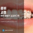 도봉구 치아교정, 교정과 미관을 한번에 해결하는 콤비교정이란? 이미지