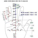 ﻿심장성 천식 증상과 서금요법 치료방법 이미지