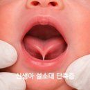 리베르소아과 설소대수술과 현대해상보험 굿리치로 청구 후기