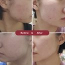 라쿠나 | 라쿠나 코스메틱 1:1 피부 온라인 컨설팅 후기