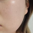 로로쥬디 탄력앰플 메타뷰티 : 건성 피부 촉촉한피부 로 만들기❤
