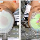 아이피메디칼 이미지