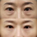 옳은손성형외과