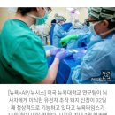 美뉴욕대서 인체 이식한 돼지 신장 32일째 정상 기능…신기록 이미지