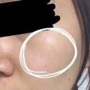 베이니아 | 베이니아 기미억제제 기미잡티 피부탄력까지 멜라닌 관리 후기 l 여자 선물 추천