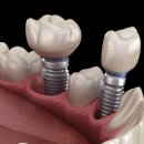 자연이치과의원 이미지